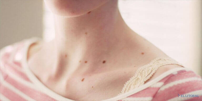 red-spots-skin