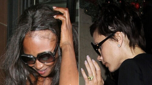 5 порад, щоб приховати рідке волосся