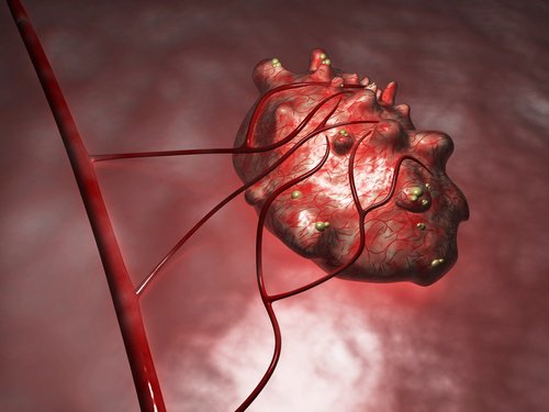 схематично зображено кісту яєчника