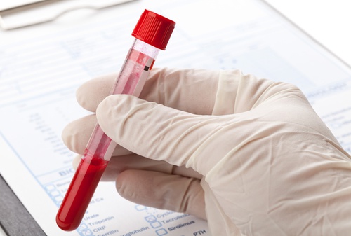 аналіз крові та лейкемія 