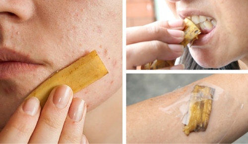 11 способів використання бананових шкірок: досить їх викидати!