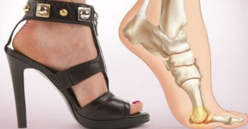5 причин перестати носити взуття на підборах