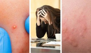 7 ознак підвищеного рівня стресу