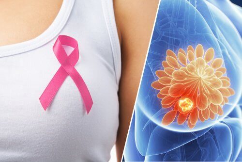 Таблетка для виявлення раку грудей