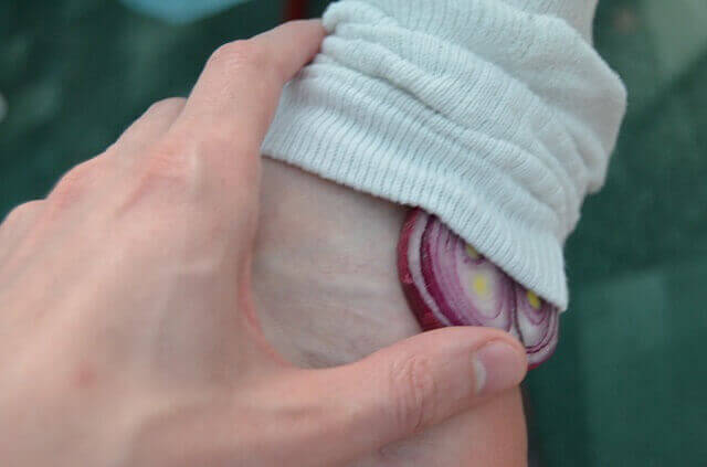 Цибуля прикладена на стопи