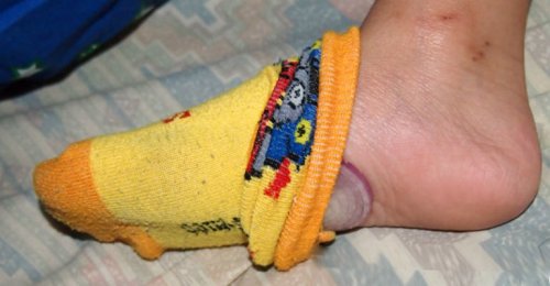 Чому варто класти цибулю на стопи на ніч