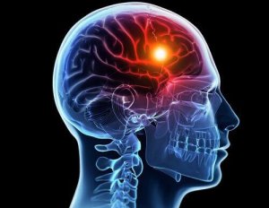 Коли головний біль стає тривожним сигналом?