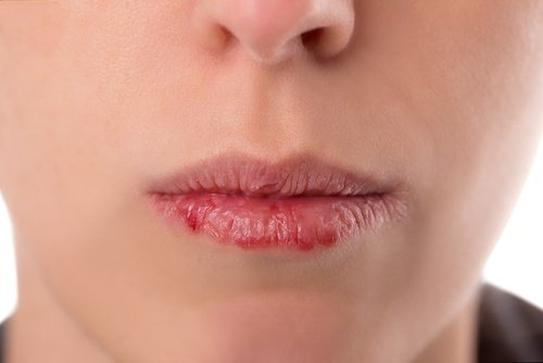 Важливо! Симптоми ротоглоткового раку, які потрібно знати