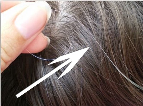 поява сивого волосся через стрес