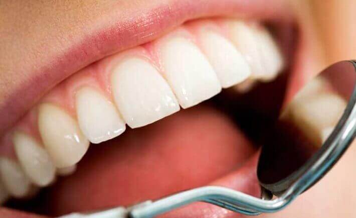 здорові зуби