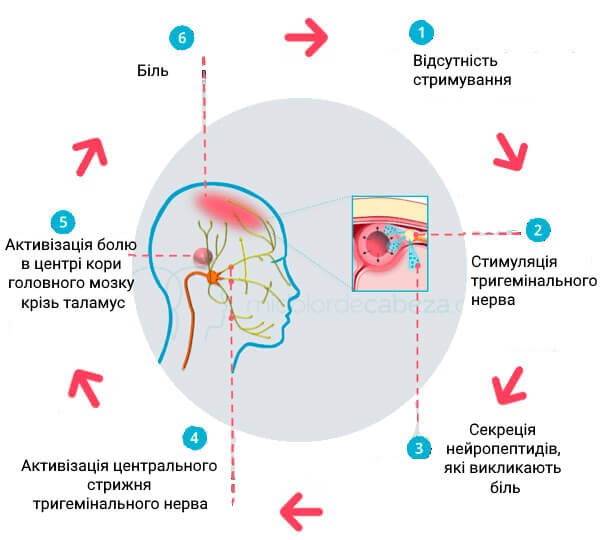 мігрень