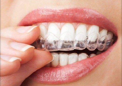 4 засоби від скреготіння зубами та змикання щелепи