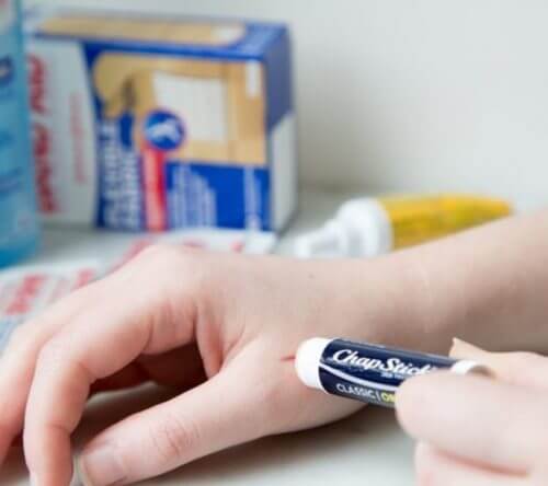 подряпина на руці