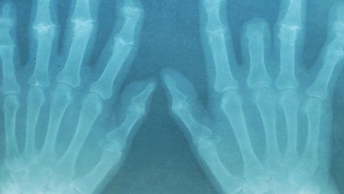 ефірні олії для м'язів