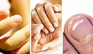5 ознак на нігтях, які вказують на негаразди зі здоров'ям