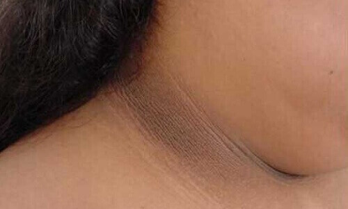 4 способи висвітлити потемнілу шкіру на шиї