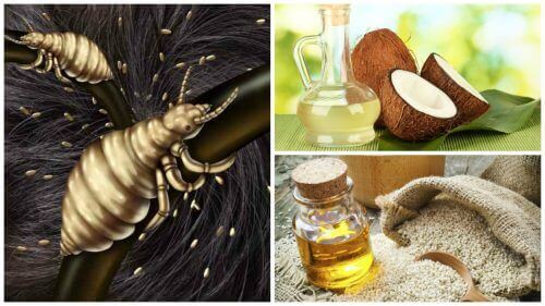 5 домашніх засобів для успішного виведення вошей