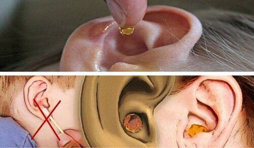Як правильно доглядати вуха