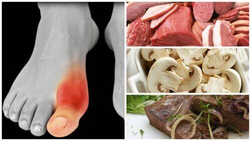 У вас подагра? Уникайте ці 7 продуктів