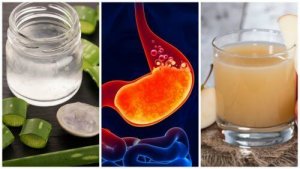 5 природних засобів, щоб звільнитися від печії
