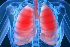 Легенева недостатність: 10 симптомів
