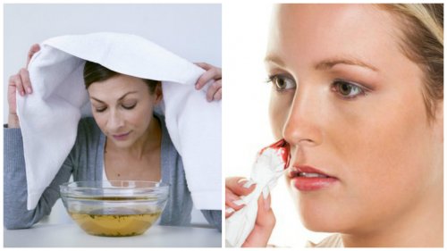 Як зупинити кров з носа: 7 ефективних порад