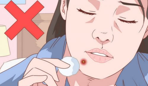 Вугри на підборідді: ефективне натуральне лікування