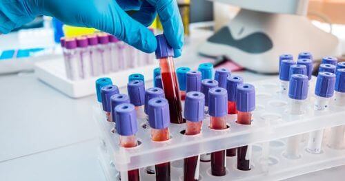 аналіз крові для раку