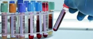 Діагностика депресії за допомогою аналізу крові