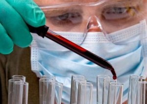 Звичайний аналіз крові може виявити наявність пухлини в організмі