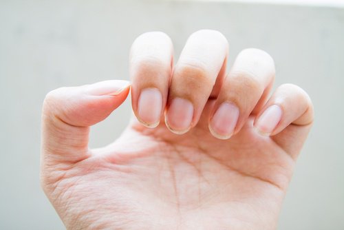 слабкі нігті можуть свідчити про проблеми з кишківником