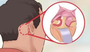 Трійчаста невралгія - найгірший біль у світі