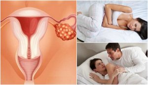 Основні симптоми раку яєчників, які повинна знати кожна жінка