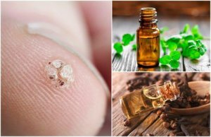 7 ефірних олій, що допоможуть позбутися бородавок