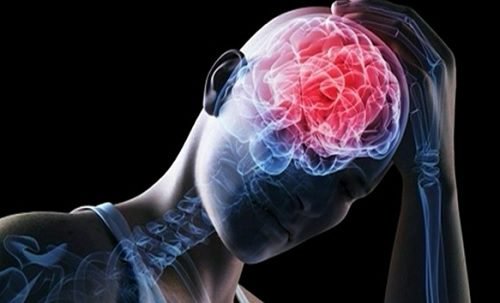 церебральна емболія