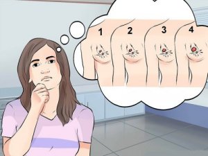 Докладно про рак грудей: різні типи, симптоми та лікування