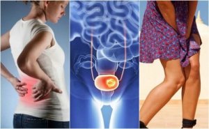 Рак сечового міхура і його 7 основних ознак