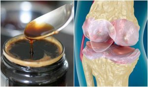 Натуральні засоби для зміцнення кісток та суглобів