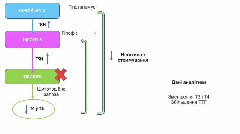 що таке гіпотиреоз