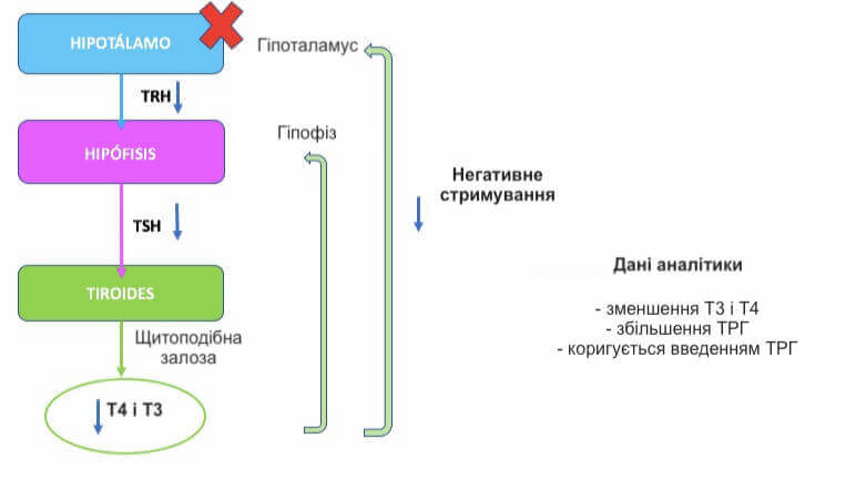 третинний гіпотиреоз