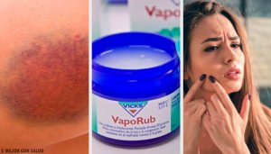 11 дивовижних способів використання мазі Vicks VapoRub