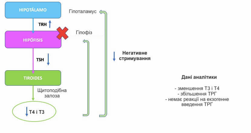 що таке гіпотиреоз