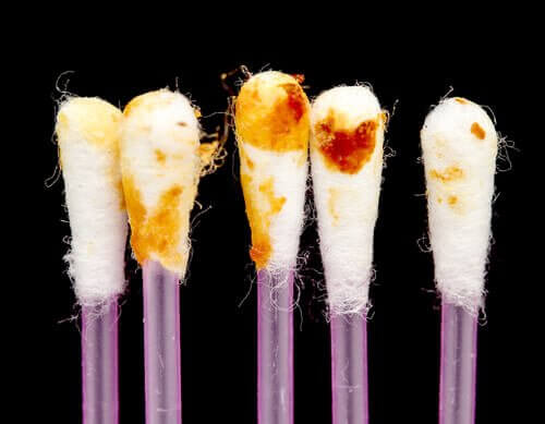 Які функції виконує вушна сірка