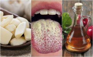 6 натуральних засобів для профілактики кандидозу