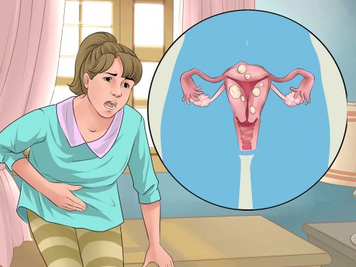 Натуральні ліки від менструального болю та інших менструальних проблем