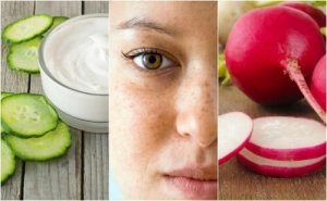 5 натуральних засобів для зменшення плям на обличчі