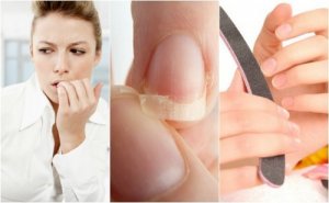 Поширені причини ламкості нігтів