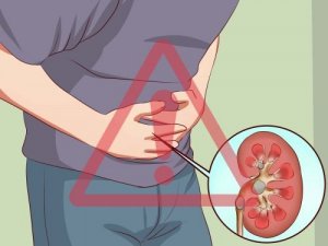 6 напоїв для полегшення болю у нирках