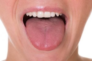 Перші п'ять ознак раку язика