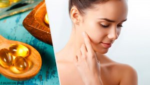 5 способів використання капсули вітаміну Е на шкірі